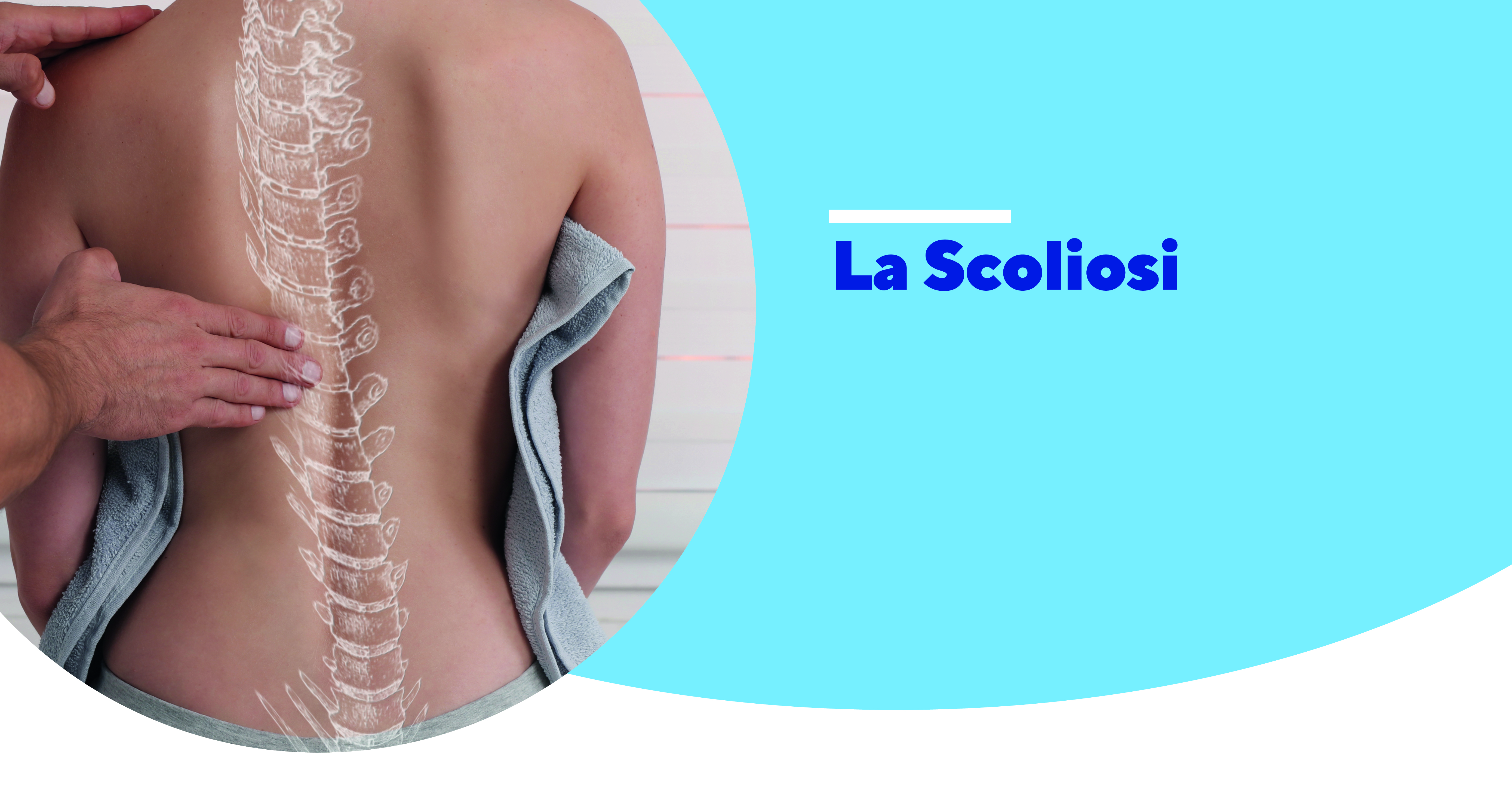 immagine-la-scoliosi